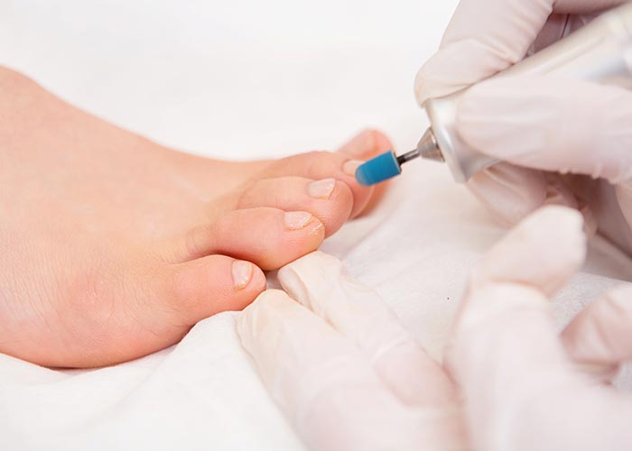 Ein Fuß, der podologisch mit einer maschinellen Feile bearbeitet wird